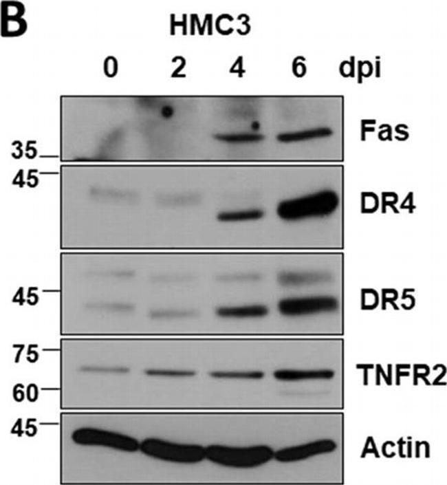 Rabbit IgG (H+L) Highly Cross-Adsorbed Secondary Antibody in Western Blot (WB)