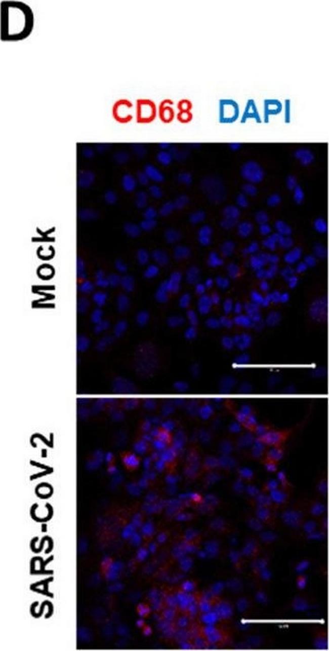 Mouse IgG (H+L) Highly Cross-Adsorbed Secondary Antibody in Immunocytochemistry (ICC/IF)