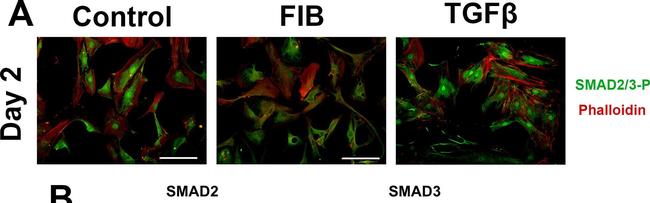 Rabbit IgG (H+L) Highly Cross-Adsorbed Secondary Antibody in Immunocytochemistry (ICC/IF)