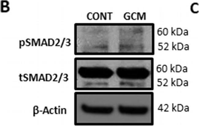 Rabbit IgG (H+L) Secondary Antibody in Western Blot (WB)