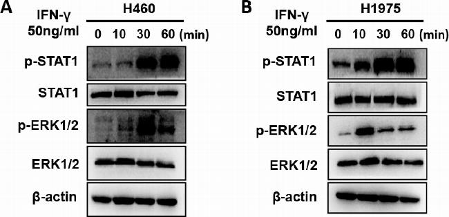 Rabbit IgG (H+L) Secondary Antibody in Western Blot (WB)