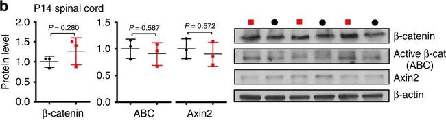 Rabbit IgG (H+L) Secondary Antibody in Western Blot (WB)