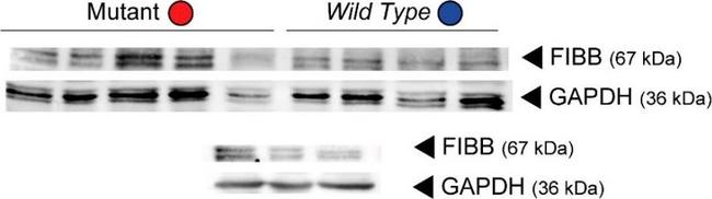 Rabbit IgG (H+L) Secondary Antibody in Western Blot (WB)