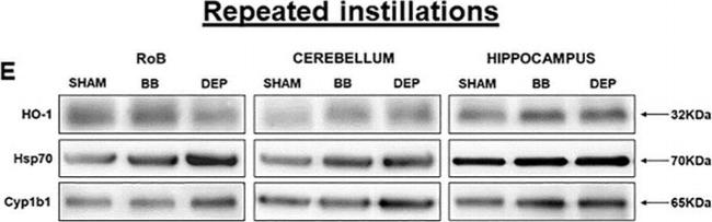 Rabbit IgG (H+L) Secondary Antibody in Western Blot (WB)