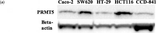 Rabbit IgG (H+L) Secondary Antibody in Western Blot (WB)