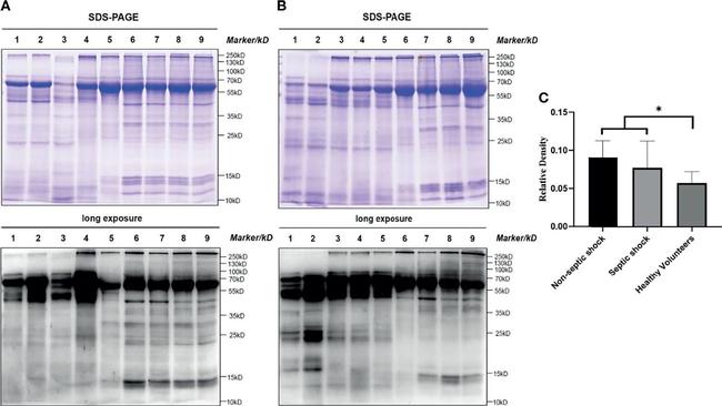 Rabbit IgG (H+L) Secondary Antibody in Western Blot (WB)