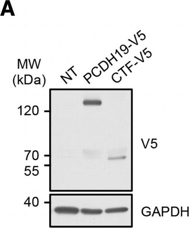 Rabbit IgG (H+L) Secondary Antibody in Western Blot (WB)