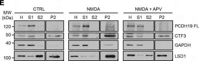 Rabbit IgG (H+L) Secondary Antibody in Western Blot (WB)