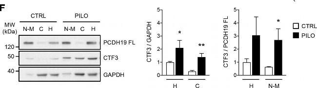 Rabbit IgG (H+L) Secondary Antibody in Western Blot (WB)