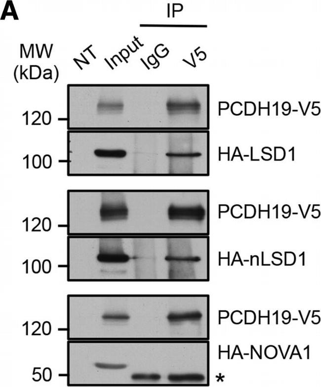 Rabbit IgG (H+L) Secondary Antibody in Western Blot (WB)