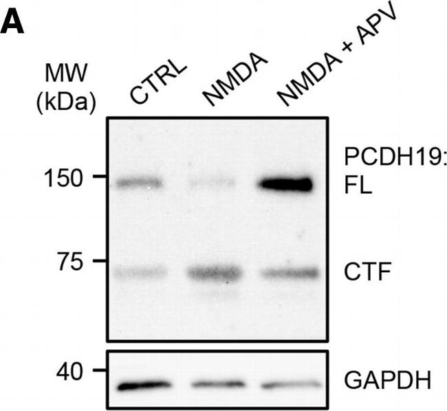 Rabbit IgG (H+L) Secondary Antibody in Western Blot (WB)