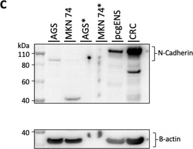 Rabbit IgG (H+L) Secondary Antibody in Western Blot (WB)