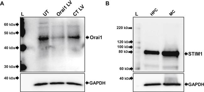 Rabbit IgG (H+L) Secondary Antibody in Western Blot (WB)