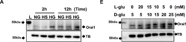 Rabbit IgG (H+L) Secondary Antibody in Western Blot (WB)