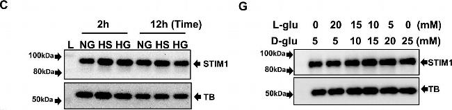 Rabbit IgG (H+L) Secondary Antibody in Western Blot (WB)