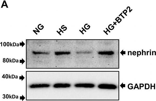 Rabbit IgG (H+L) Secondary Antibody in Western Blot (WB)