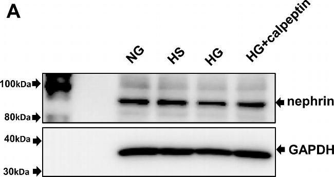 Rabbit IgG (H+L) Secondary Antibody in Western Blot (WB)