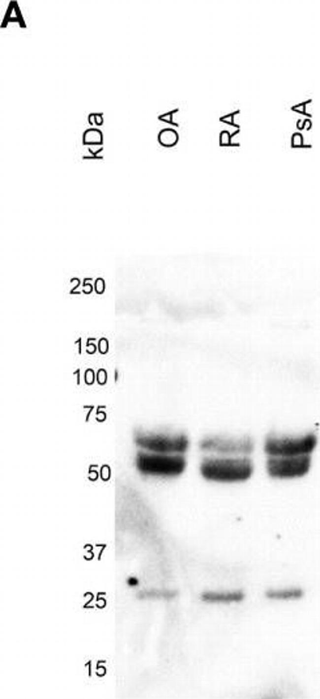 Rabbit IgG (H+L) Cross-Adsorbed Secondary Antibody in Western Blot (WB)