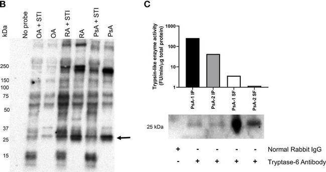 Rabbit IgG (H+L) Cross-Adsorbed Secondary Antibody in Western Blot (WB)