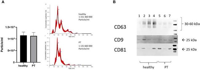 CD9 Antibody in Western Blot (WB)