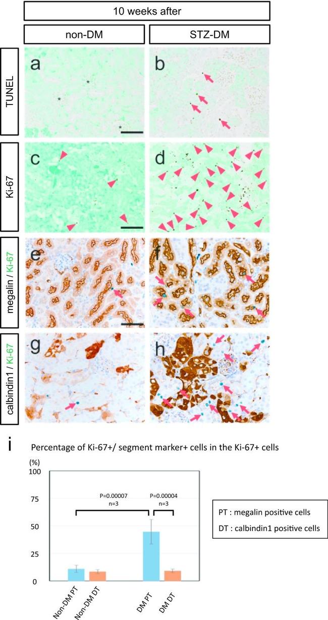 Ki-67 Antibody in Immunohistochemistry (IHC)