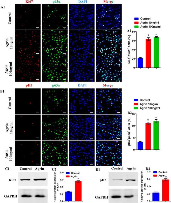 Phospho-Histone H3 (Ser10) Antibody in Western Blot (WB)