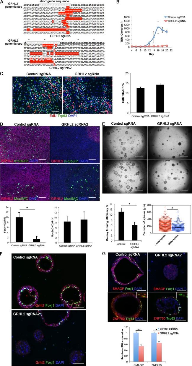 FOXJ1 Antibody in Immunocytochemistry, Immunohistochemistry (ICC/IF, IHC)