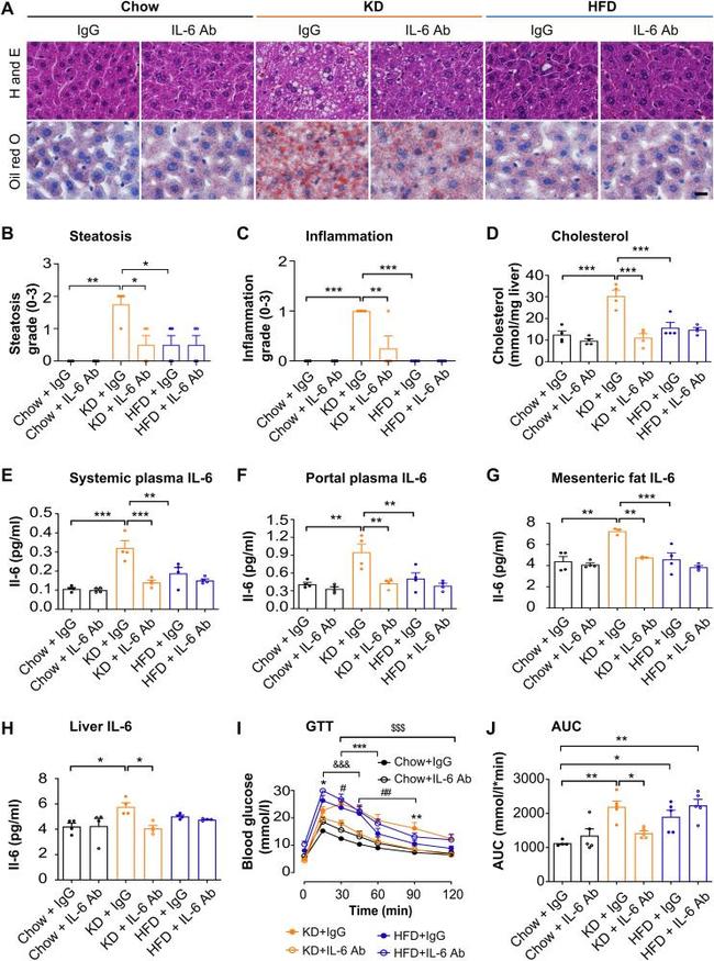 IL-6 Antibody in Neutralization (Neu)