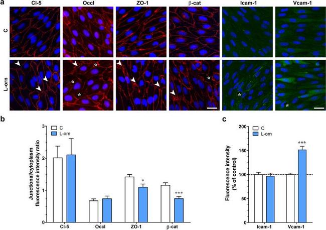 ICAM-1 Antibody in Immunocytochemistry (ICC/IF)