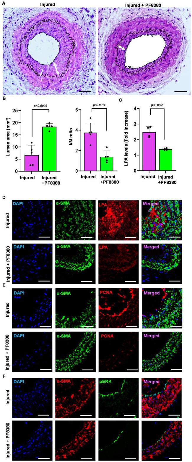 PCNA Antibody in Immunohistochemistry (IHC)