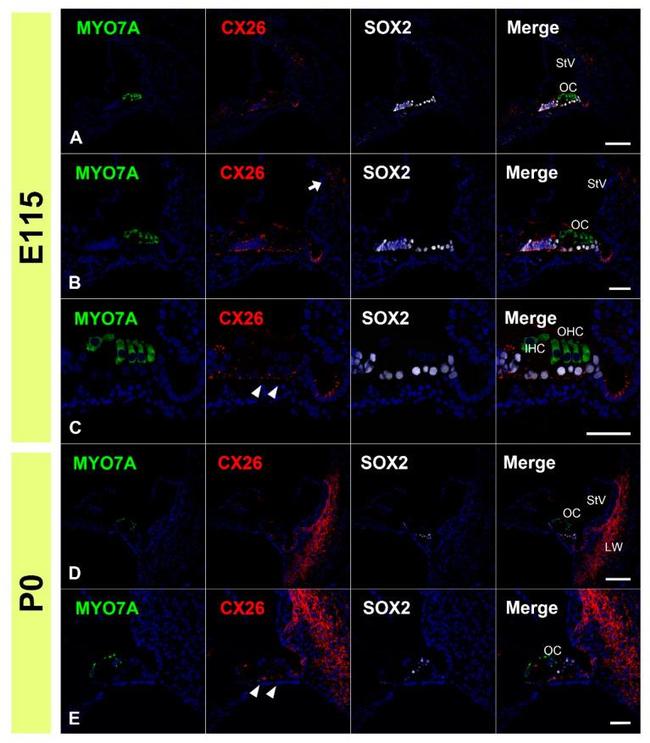 Connexin 26 Antibody in Immunohistochemistry (IHC)