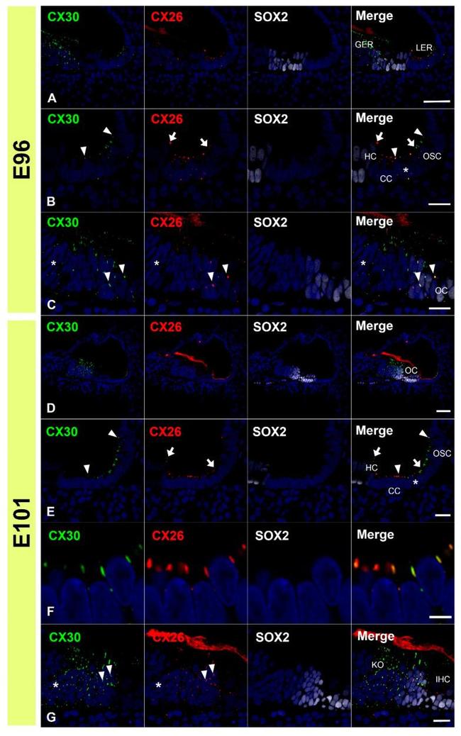 Connexin 26 Antibody in Immunohistochemistry (IHC)