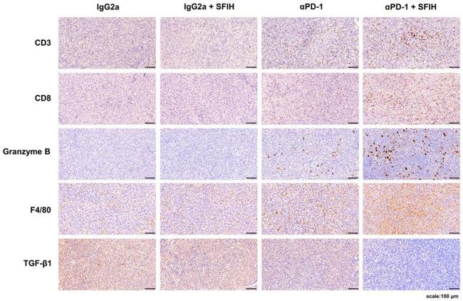 Granzyme B Antibody in Immunohistochemistry (IHC)