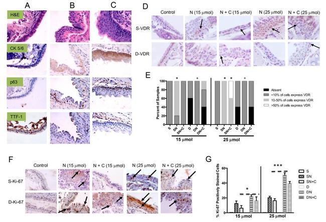 VDR Antibody in Immunohistochemistry (IHC)