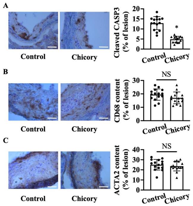 Alpha-Smooth Muscle Actin Antibody in Immunohistochemistry (IHC)