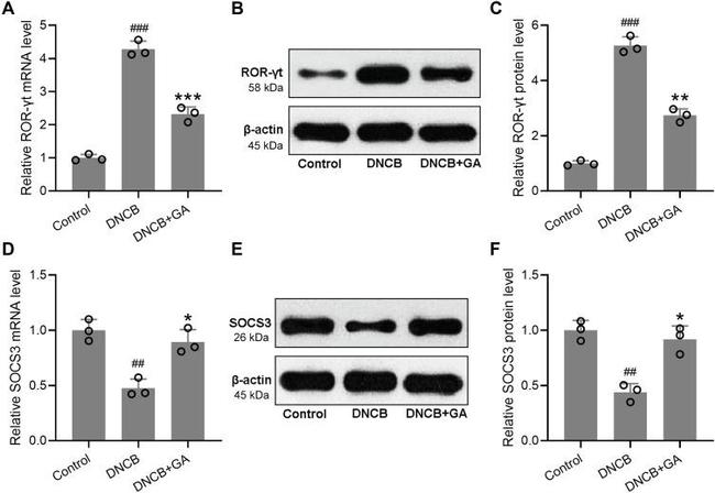 ROR gamma (t) Antibody in Western Blot (WB)