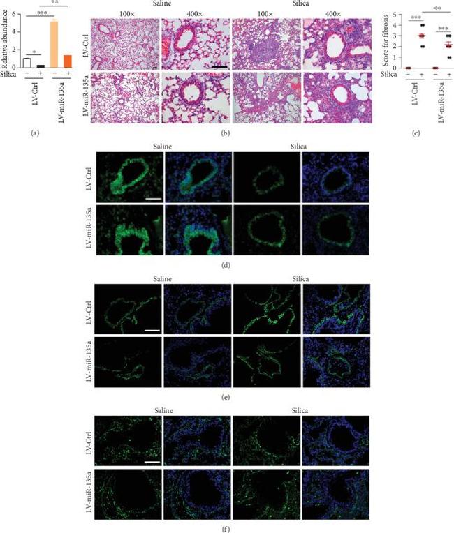 Alpha-Smooth Muscle Actin Antibody in Immunohistochemistry (IHC)