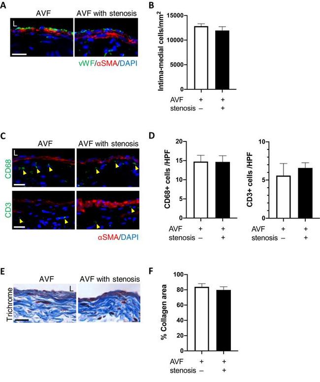 Alpha-Smooth Muscle Actin Antibody in Immunohistochemistry (IHC)