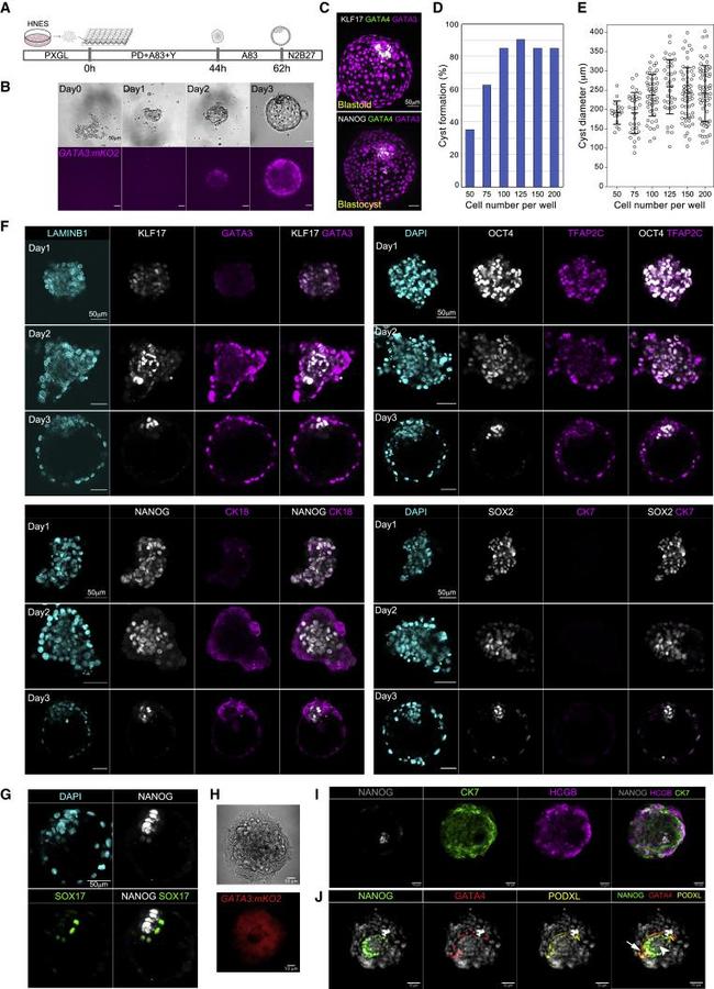 GATA3 Antibody in Immunocytochemistry (ICC/IF)