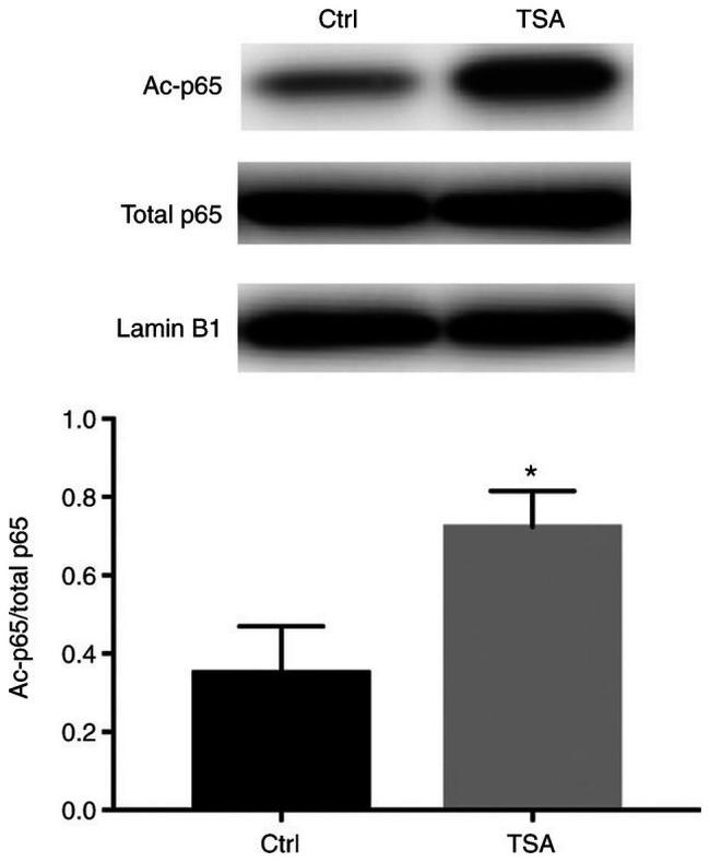 Lamin B1 Antibody in Western Blot (WB)