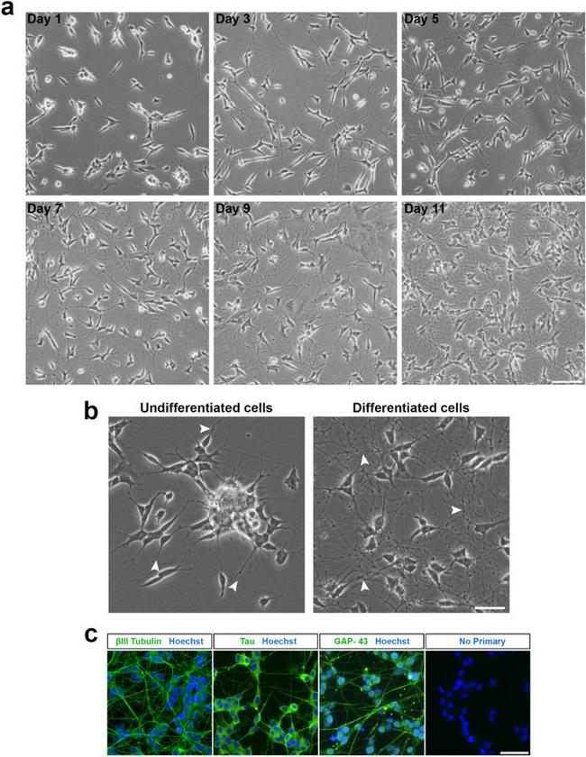 GAP43 Antibody in Immunocytochemistry (ICC/IF)