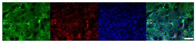 ZO-1 Antibody in Immunocytochemistry (ICC/IF)