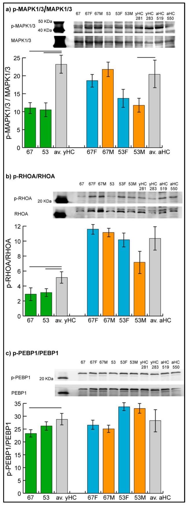 PEBP1 Antibody in Western Blot (WB)