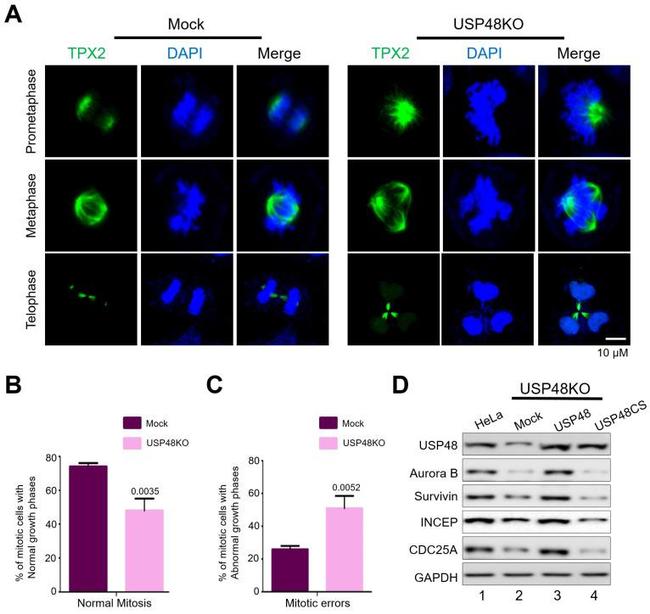 Aurora B Antibody in Western Blot (WB)