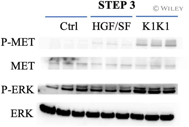 c-Met Antibody in Western Blot (WB)