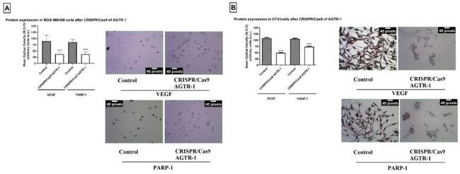 PARP1 Antibody in Immunocytochemistry (ICC/IF)