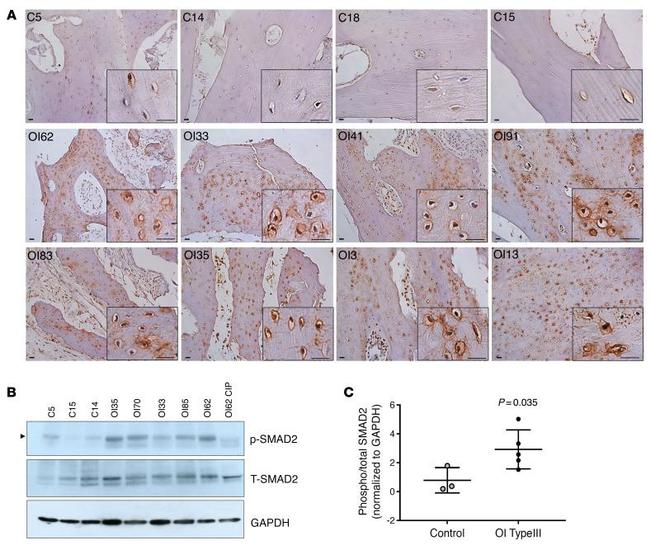 Phospho-SMAD2 (Ser465, Ser467) Antibody in Immunohistochemistry (IHC)