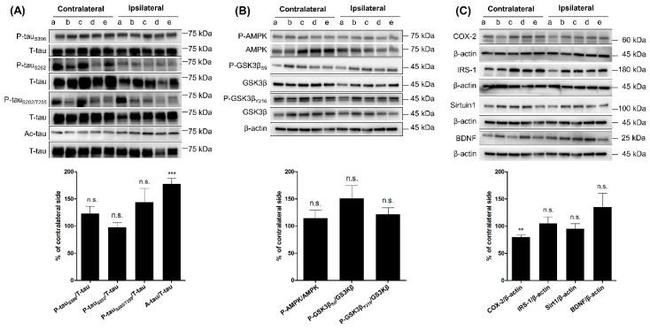 Phospho-Tau (Ser262) Antibody in Western Blot (WB)