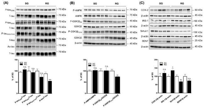 Phospho-Tau (Ser262) Antibody in Western Blot (WB)