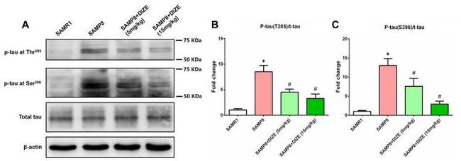 Phospho-Tau (Ser396) Antibody in Western Blot (WB)